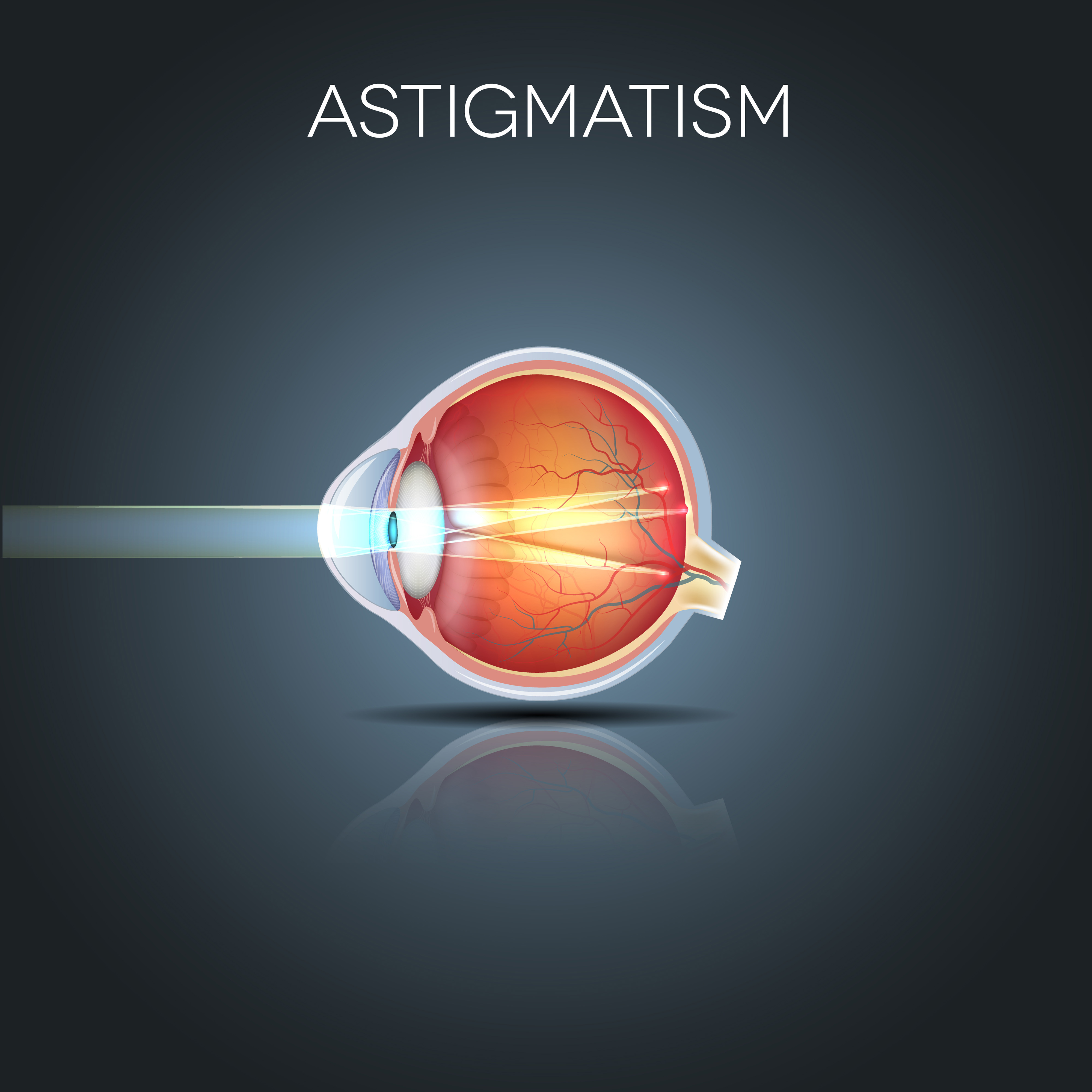 Ten things to Know about Astigmatism Better Vision Guide